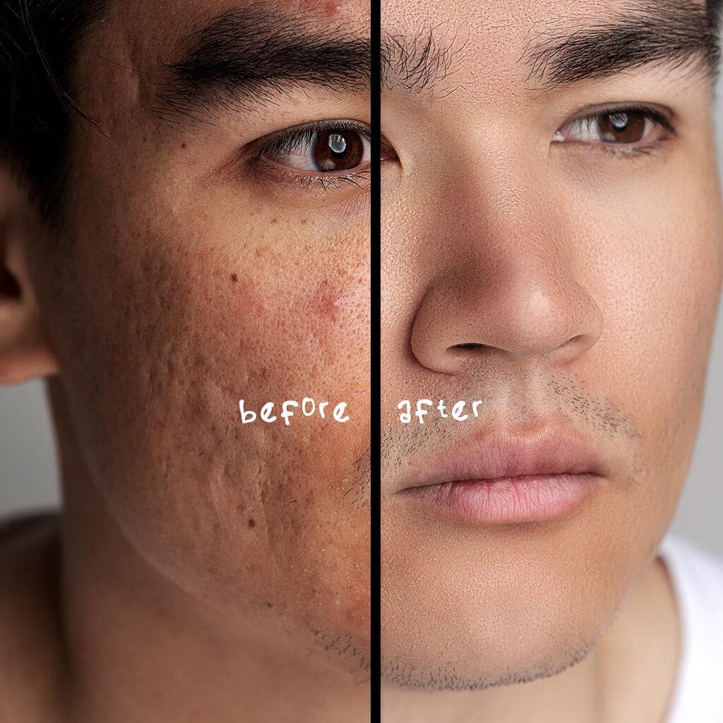 Action Skin Retouch Photoshop